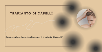 Trapianto di capelli